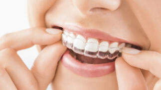 Férula de descarga + revisión dental